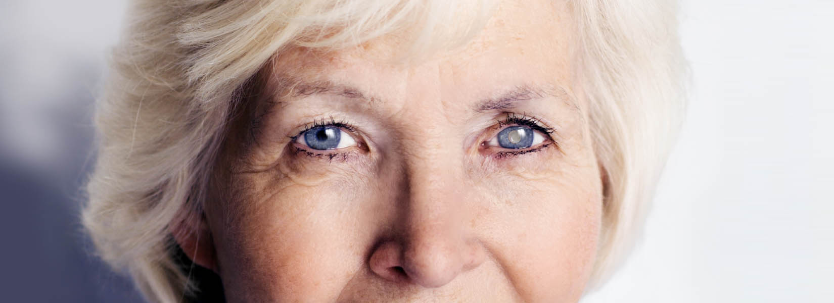 Cataract Surgery in North Central